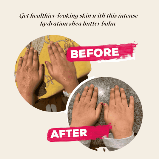 Before-and-after graphic showing moisturizing balm applied to hands from two tin views