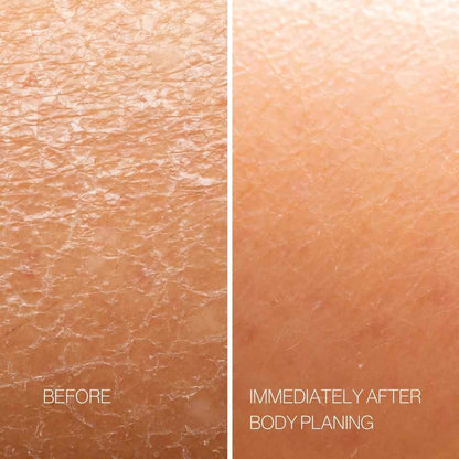Skin texture before and immediately after exfoliating body planning