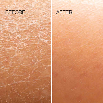 Before-and-after skin exfoliation close-up showing smoother texture on the after side