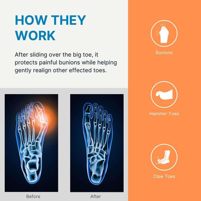 Bunion guard spacer illustrated with before-and-after foot diagrams and bunion icons