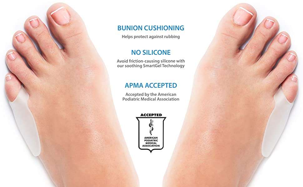 Gel toe bunion guards on both feet, soft translucent sleeves