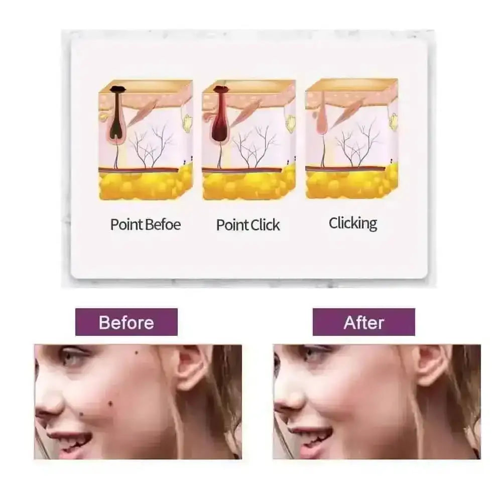 Portable Multi Level Beauty Equipment DailySale Default Title Default Title-