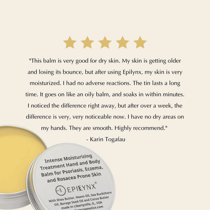 Open silver tin of yellow moisturizing balm with label on the lid and star ratings