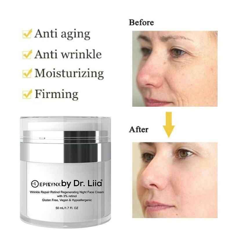 Wrinkle Repair Retinol Night Cream – Vegan, Gluten-Free, Regenerating Anti-Aging Moisturizer Cartsfy Inc.